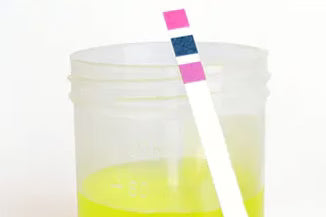 A plastic container with yellow liquid and an Alka® pH test strip showing color changes above the container, available at Fisa Health.